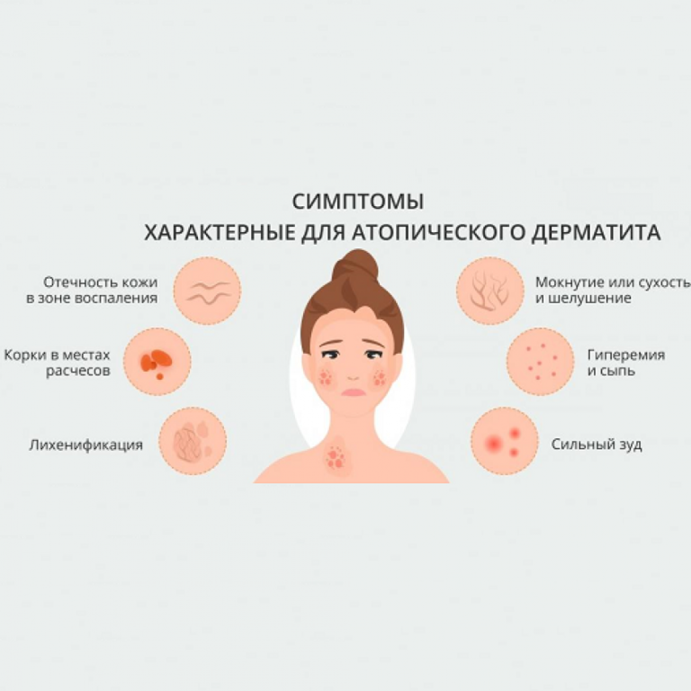 Atopy1-848x848