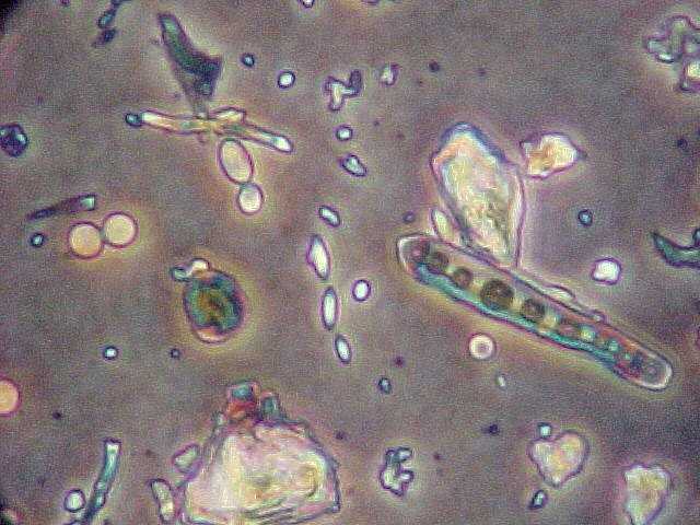 Helminthosporium halodes