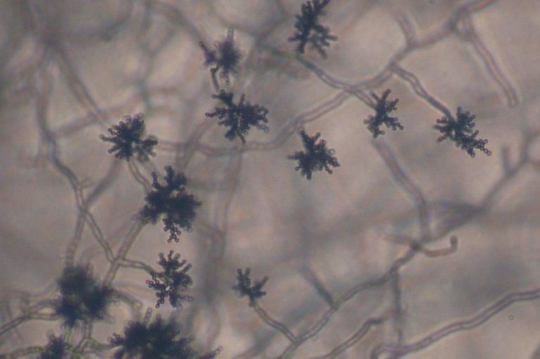 Cladosporium herbarum