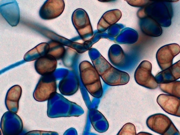 Curvularia lunata