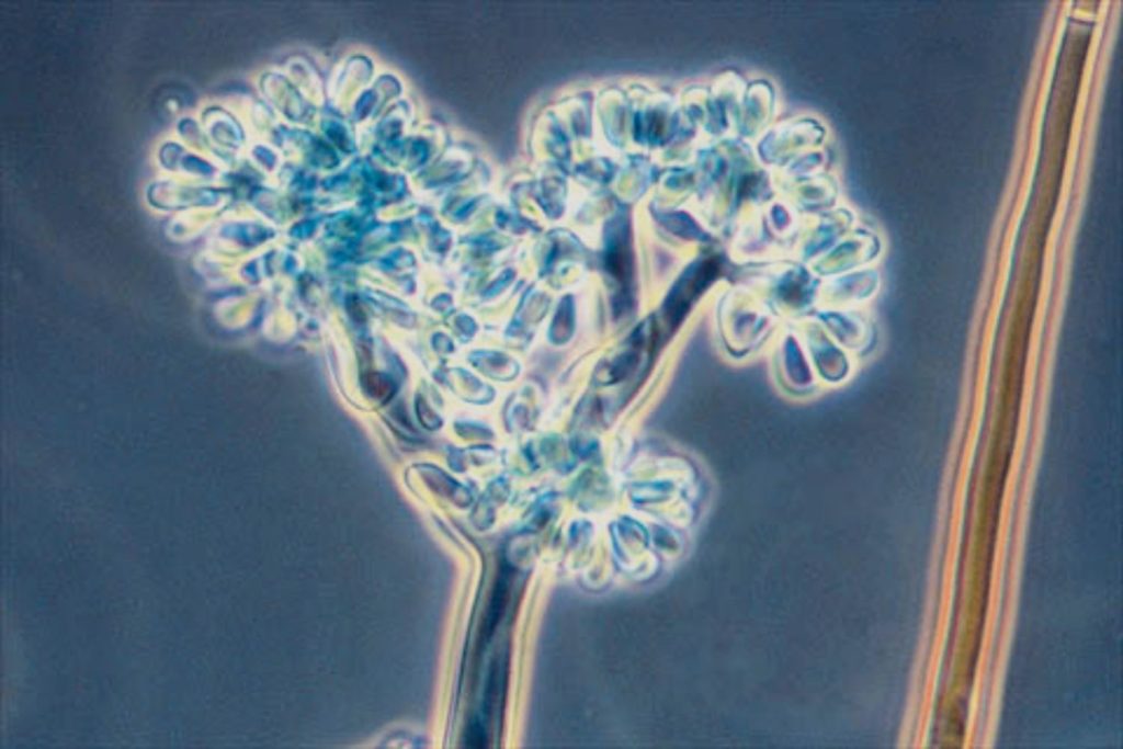Botrytis cinerea