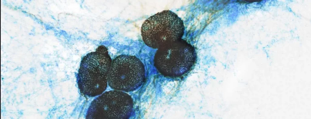 Phoma betae