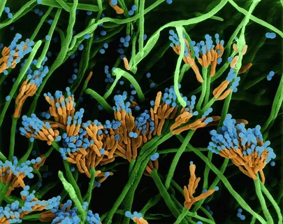 Penicillium roqueforti