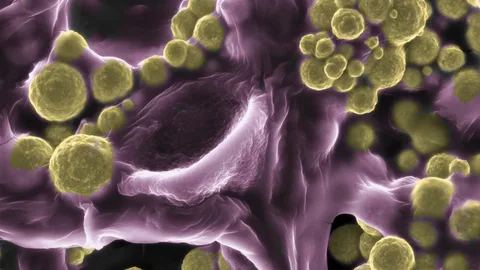 Fusarium oxysporum
