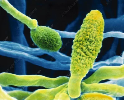 Alternaria alternata (tenuis)