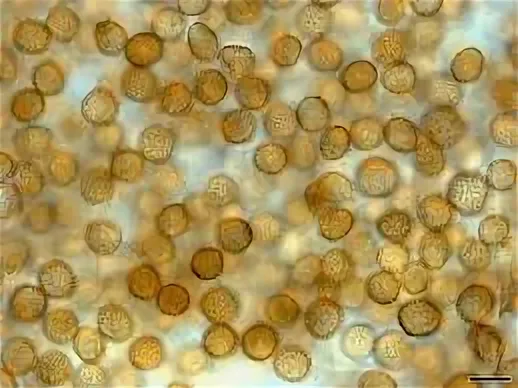 Ustilago cynodontis