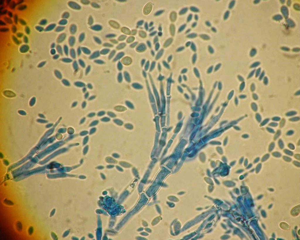 Paecilomyces variotii