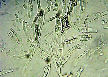 Penicillium digitatum