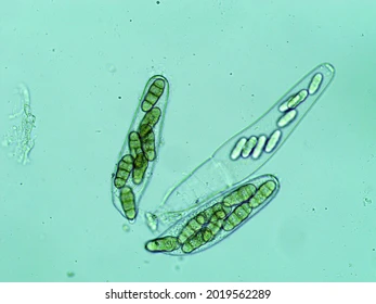 Microsporum canis