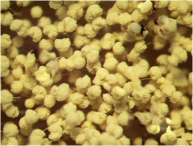 Aspergillus terreus