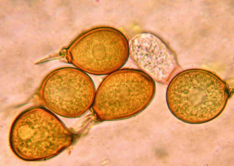 Ustilago tritici
